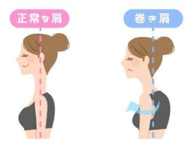 肩こりと巻き肩の関係を整体でリセットする方法とは？根本改善のヒント
